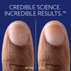 ePhD Bond Repair Nail Treatment, Nail Repair that Strengthens, Restores & Rebuilds Brittle Nails, Strengthens from Within, Formula for Damaged, or Post-Gel Nails, Use Alone or as a Polish Base view 4