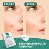 Veeda Glow Pimple Patches Hydrocolloid Acne Patches for Face, Absorb Pus & Flatten Blemishes Overnight, Invisible Zit Spot Treatment, Non-Irritating Blemish Covers, 36 Count view 3