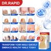 Toenail Fungus Treatment Extra Strength - 20 Hydrogel Patches for Overnight Nail Repair, 8-Hour Nighttime Fungal Nail Patches, Restores Healthy Appearance, Waterproof & Painless Relief view 2
