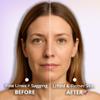 5-in-1 Microcurrent Facial Device for Face Tightening, Lifting & Wrinkle Reduction  Non-Invasive Anti Aging Tool, Jawline Shaper & Skin Lifting Face Sculpting Device for At-Home Skincare view 4