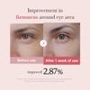 medicube Salmon DNA PDRN Pink Peptide Eye Serum with Niacinamide and 99% Purity Retinol for Fine Lines, Uneven Skin Tone, Korean Skin Care 1.01fl.oz view 4