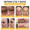 Bee Venom Comprehensive Cream, Professional Bee Venom Skin Treatment Cream for Removing and Repair, Natural Bee Venom Cream Suitable for All Skin Types (3PC) view 3