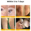 Bee Venom Comprehensive Cream, Professional Bee Venom Skin Treatment Cream for Removing and Repair, Natural Bee Venom Cream Suitable for All Skin Types (3PC) view 4