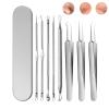 Acssart Blackhead Tools, Acssart Stainless Steel Blackhead Remover Tool Kit, Acssart Blackhead Removal Tools, Loyaltyness Tweezers, Professional Facial Blackhead Remover Tweezers (A) view 1