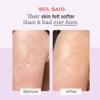 First Aid Beauty - Jumbo Body Duo: KP Bump Eraser Body Scrub & Ingrown Hair Pads with 10% BHA & AHA, Daily Exfoliating Body Scrub, Keratosis Pilaris Treatment to Reduce Bumps (10 oz Scrub, 60 Ct Pads) view 3