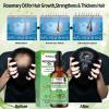 3 Pack Rosemary Oil for Hair Growth,Rosemary Hair Growth Oil,Strengthening Oil for Dry Damaged Hair,Hair Loss Treatment & Thickens Hair,Scalp Care Promotes Hair Thickness for Men Women view 4