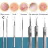 DUYHBAWRS 11PCS Acne Blackhead Removal Needles Skin Care Cleaning Tool Kit Pore Cleaning view 4
