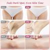 Skin Lightening Cream for Intimate Area Dark Spot Remover Skin Whitening Cream for Sensitive Part Underarms, Inner Thighs, Bikini Line, Knees and Elbows Bleaching Body Cream (1.76 Fl Oz) view 3