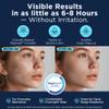 Pimple Patches for Face - 134 Count Hydrocolloid Acne Patches - Zit, Blemish, Cystic Acne Dots & Dark Spot Treatment - Invisible Clear Pimple Patch Stickers for Forehead, Chin, Nose, 3 Sizes (S, M, L) view 4