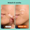 TKTK Pimple Patches for Face, 6 Sizes Hydrocolloid Acne Patch Variety, Large Acne Stickers for Cheeks, Forehead, Chin, Nose, Back Blemishes Zit Breakouts (4 Shapes 356 Count) view 3