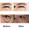 Abera Eye Roller Serum  Eye Bags Treatment For Men with Mint, Vitamin C & Peptides  Cooling Roller for Puffiness & Dark Circles  0.34 Fl Oz view 4