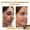 Bee Venom All in One Cream, Bee Venom Skin Treatment Cream, Effective all-in-One skin Treatment cream, Repair, Moisturize and lift 3 in 1, for All Skin Types (3 Bottle) view 3