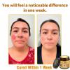 Bee Venom All in One Cream, Bee Venom Skin Treatment Cream, Effective all-in-One skin Treatment cream, Repair, Moisturize and lift 3 in 1, for All Skin Types (3 Bottle) view 4