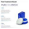 AETERDERM PURI EYES PDRN PATCH view 4