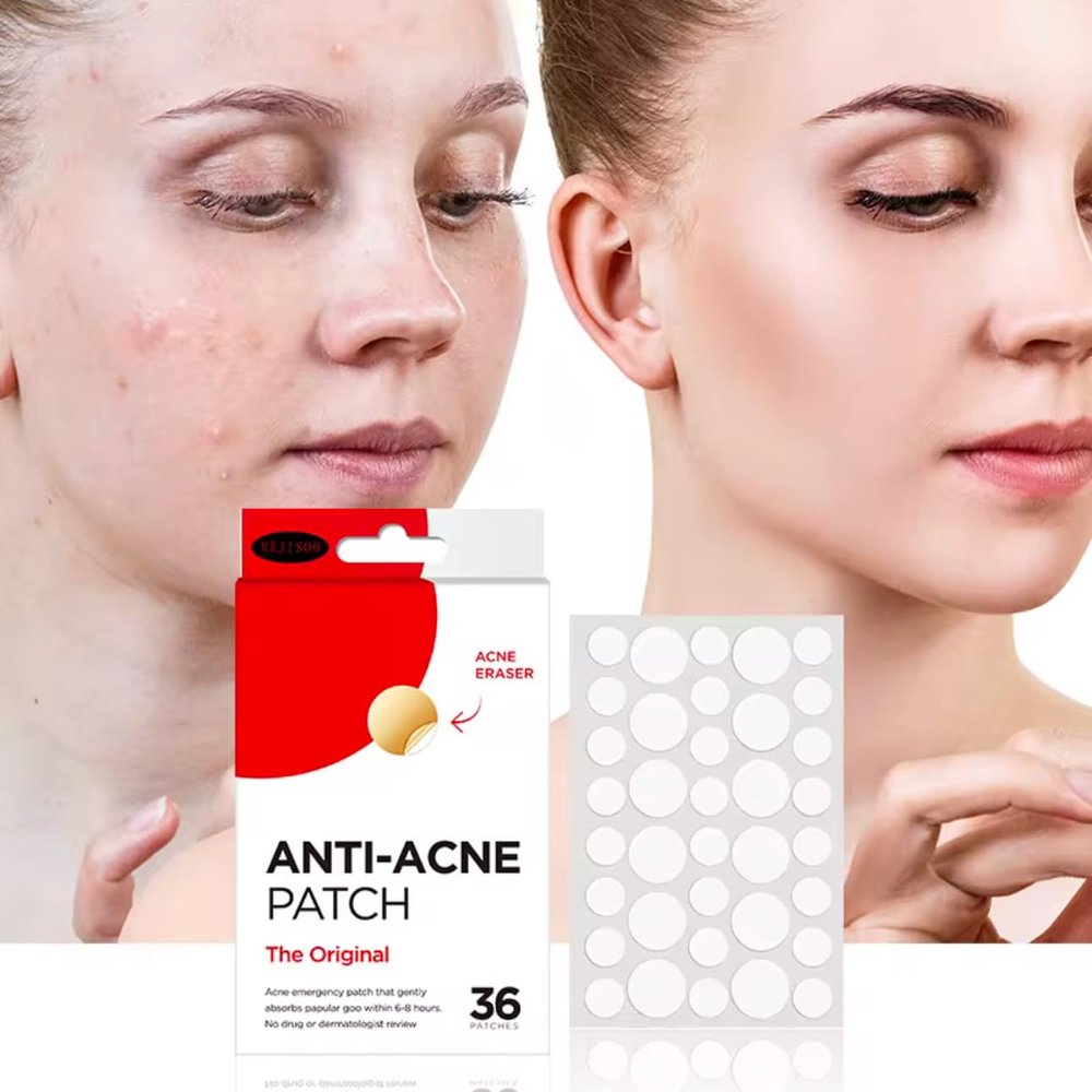 Anti-Acne Patch, Original Emergency Spot Treatment, 36 Patches, Absorbs Pus and Soothes Skin