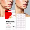 Anti-Acne Patch, Original Emergency Spot Treatment, 36 Patches, Absorbs Pus and Soothes Skin view 3