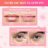 30 Pcs Lip Masks & Under Eye Masks, 24K Gold Gel Crystal Collagen Under Eye Patches for Puffy Eyes and Dark Circles, Effectively Moisturizing the Lip & Eye Skin, Reducing Wrinkles & Fine Lines view 3