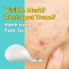 Troubless Micro Patch Plus Vitamin C - Zit Hydrocolloid Patch for Stubborn Marks with 10% Vitamin C - Micro-Dissolving Pyramids for High-Absorption, Seamless Adhesion & Easy-Wear (9 EA) view 3