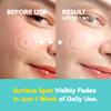 Troubless Micro Patch Plus Vitamin C - Zit Hydrocolloid Patch for Stubborn Marks with 10% Vitamin C - Micro-Dissolving Pyramids for High-Absorption, Seamless Adhesion & Easy-Wear (9 EA) view 4