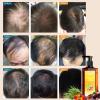 BUIITI Batana Oil Shampoo for Hair Growth  Infused with Rosemary & Onion, Anti Hair Loss & Thickening Treatment for Women & Men, Promotes Regrowth, Sulfate Free Natural Formula, 10.14 fl oz view 2