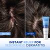 Hermon Seborrheic Dermatitis Scalp Treatment Cream: Soothing Itching Redness Scaling of Seborrheic Dermatitis - Fast-Acting Anti-Itch Ointment for Scalp Face Chest and Body for Men and Women 1 Pack view 4