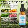 Eye Serum For Chalazion & Blepharitis, 2 PCS Chalazion Remover For Eyelid, Eyelid Serum With Avocado Oil, Sea Buckthorn Oil & Caffeine, Relieve Puffiness and Eye Fatigue view 3