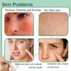 JunKuJK 8PCS Purity Aloe Vera Gel - Hydrating Aloe Vera Gel for Face and Skin,No Sticky Moisturizing Aloe Gel O view 3
