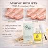 Dead Sea Cuticle & Nail Oil 5ml | Strengthens Nails & Deeply Moisturizes Dry, Cracked Cuticles | With Jojoba, Argan, Olive, Almond & Castor Oils + Vitamin E | Nail Repair & Growth Treatment view 3