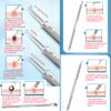 Blackhead Remover Tweezers, with Storage Case and Mirror Stainless Steel Blackhead Remover Kit, Craft Tweezers Acne Remover Tools (8pcs) view 3