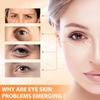 2PCS Revive Glow Vitamin C Eye Balm, Reducing Dark Circle,Hydrating Eye Cream,Improve Dark Circles,Reduces Puffiness (3pcs) view 2