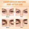 2PCS Revive Glow Vitamin C Eye Balm, Reducing Dark Circle,Hydrating Eye Cream,Improve Dark Circles,Reduces Puffiness (3pcs) view 4