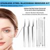 Acssart Blackhead Tools,Acssart Tweezers, Stainless Steel Blackhead Remover, Pimple Acne Remover Kit,Professional Facial Comedone Pimple Extractor Tool Kit view 2