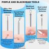 Acssart Blackhead Tools,Acssart Tweezers, Stainless Steel Blackhead Remover, Pimple Acne Remover Kit,Professional Facial Comedone Pimple Extractor Tool Kit view 4