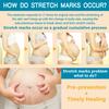PEGO Stretch Mark Oil for Pregnancy, Maternity Body Oil for Stretch Mark Prevention & Reduction, Hydrating Skin Care, 5.41oz (Oil+Cream) view 2