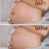 PEGO Stretch Mark Oil for Pregnancy, Maternity Body Oil for Stretch Mark Prevention & Reduction, Hydrating Skin Care, 5.41oz (Oil+Cream) view 4