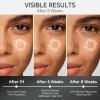 AgeSerene Face Moisturizer for Women, Anti-Aging Night Cream to Reduces Wrinkles and Firms Skin, Boosts Collagen | 48H Hydration, Peptides, Vitamin C & Vit E, Tightening Skin Care view 4