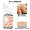 Acne Pimple Patch - 3 Sizes 48 Patches, Invisible Hydrocolloid Zit Stickers, Spot Covers for Face, Cute Round Shape, Camping Hiking Travel Essentials Gift view 4