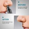 YREAJZVS Nose Hair Trimmer-Professional Painless Ear and Nose Hair Trimmer for Men and Women, Waterproof Dual Edge Blades for Easy Cleaning, 3 in 1 Ear Nose Eyebrow and Facial Trimmer view 3