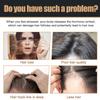 2 Pcs Root Activator Shampoo, Hair Growth Root Activator Shampoo, For Anti-Hair Loss, Natural Formula for Men and Women view 2
