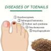 72 Pcs Nail Repair Patches, Nail Repair for Damaged Nails and Appearance of Discolored view 4