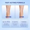 Hermon Varicose Veins Cream, Varicose Veins for Legs, Spider Vein for Legs, Natural Soothing Leg Varicose & Spider Veins Cream - 5.07 Fl Oz (Pack of 1) view 4