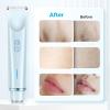 2025 New 2 in 1 Electric Shaver for Women, 2 in 1 Double-Headed Waterproof Wet and Dry, Dual Head Body Shaver Electric Trimmer for Women (Blue) view 3