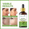 MAHANT Gentle Face Serum with Aloe Vera, Pro Vitamin B5 & Vitamin E  Helps Improve Skin Texture  Suitable for All Skin Types  30ml view 2