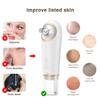 KinseiBeauty Electric Blackhead Remover Vacuum,Facial Suction Pore Cleanser, Acne Comedone Whitehead Blackhead Extractor Tool with 4 Removable Suction Heads,3 Suction Modes for Women and Men view 4