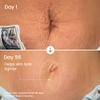 MALYS Cosmetics B-FLAT Belly Firming Cream - Stretch Mark Tightening Belly Cream - 2 Pack view 4