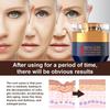 UUniqueGift Qinglin Face Cream, Crema Para Arrugas, Wrinkle Removal Cream, Polypeptide Tightening and Anti-Wrinkle Cream for Women Men (2) view 3