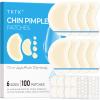 TKTK Chin Pimple Patches (100 Count 6 Sizes), XL Contoured Hydrocolloid Chin Patch 62x42 mm, Large Acne Patch for Face Blemishes Zit Breakouts, Maximum Absorption Overnight Stickers view 1