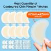TKTK Chin Pimple Patches (100 Count 6 Sizes), XL Contoured Hydrocolloid Chin Patch 62x42 mm, Large Acne Patch for Face Blemishes Zit Breakouts, Maximum Absorption Overnight Stickers view 2
