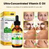 ATOANY Vitamin E Oil 75,000 IU 2 Fl Oz - 100% Pure Vitamin E Oil for Skin, Face, Hair, Body - Natural Antioxidant for Dryness, Wrinkles, Scars & Stretch Marks, Moisturizing and Firming Skin view 4
