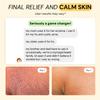 MyMagicHealer Universal Flare Care | Essential Oil Free | Relief for Rashes, Eczema, Psoriasis, Hidradenitis Suppurativa, Impetigo, Dermatitis, Wound Care, Sensitive Skin w/Propolis & Egg Yolk 1 oz view 4